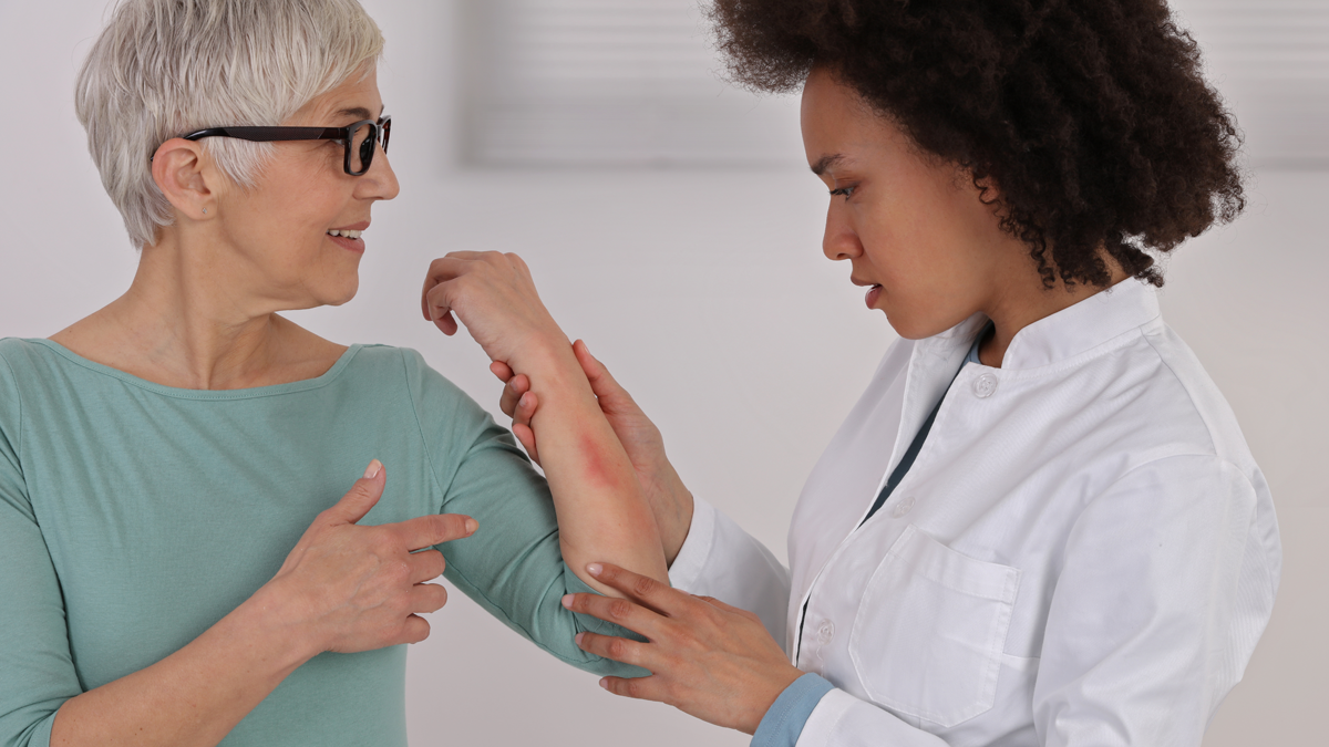 Doctor examining patient’s arm rash during Food Allergy Clinical Trials at Equity Medical research site in New York City